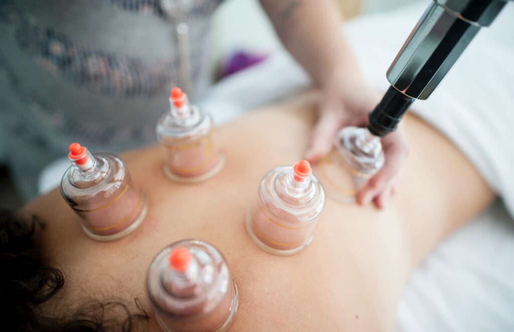 patient enjoying cupping therapy on a table